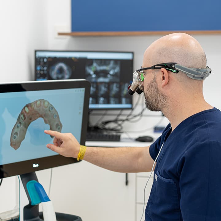 Sonrisa completa con implantes dentales